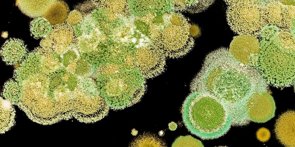 Tips for a MoldFree Home